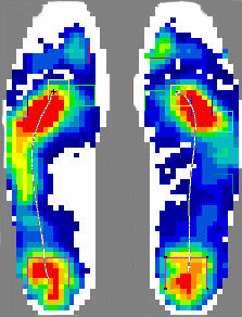 Foot Pressure