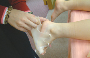foot casting