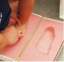 cast foot