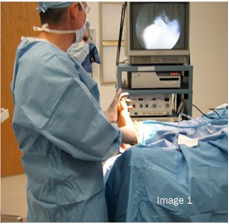 heel spur surgery